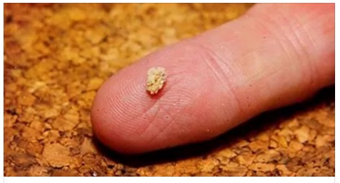 COLPISCE UOMINI E DONNE TRA I 20 E I 40 ANNI: ECCO A COSA FARE ATTENZIONE - 02/03/2016