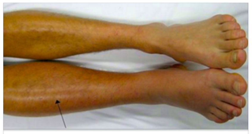 NOTATE UNA COSA DEL GENERE SULLE VOSTRE GAMBE? ATTENZIONE, ECCO COSA VI SUCCEDE - 17/04/2016
