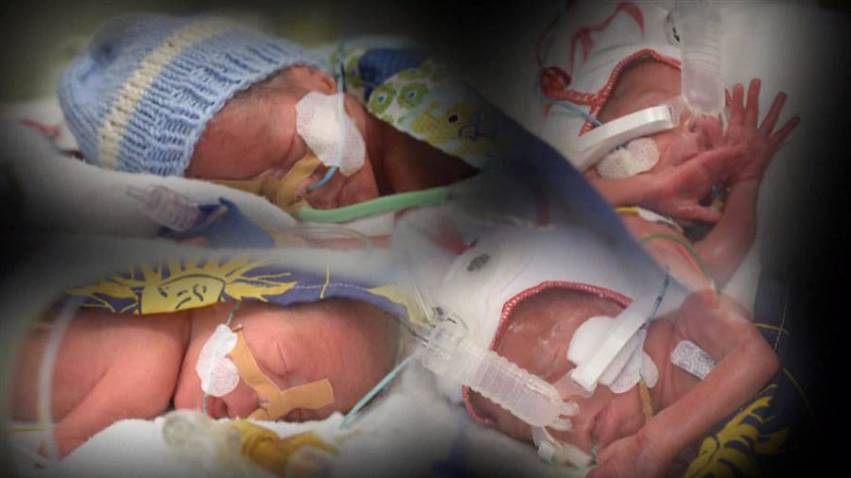 NATI I 4 GEMELLINI FIGLI DELLA DONNA DI 65 ANNI GIA' MADRE DI 13 FIGLI MA ORA LOTTANO PER LA VITA - 20/06/2016