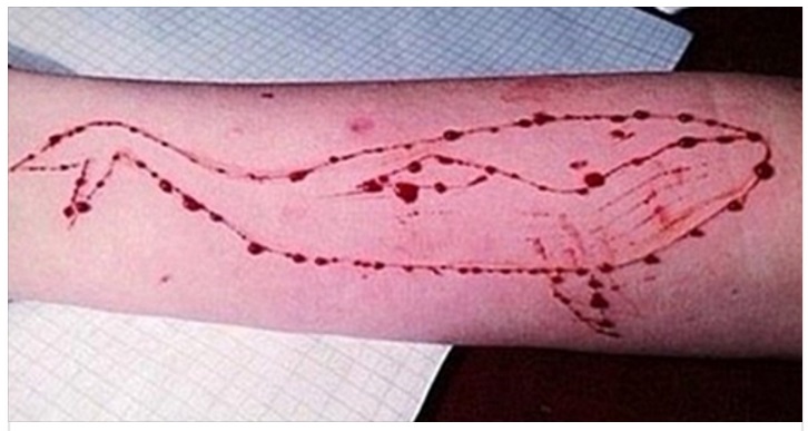 IL NUOVO GIOCO DELL'ORRORE HA GIA' PORTATO ALLA MORTE 130 ADOLESCENTI: ECCO IN COSA CONSISTE IL ''BLUE WHALE'' - 04/03/2017