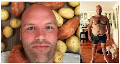 HA MANGIATO SOLO PATATE OGNI GIORNO PER UN ANNO: ECCO IL SUO ASPETTO ORA - RESTERETE MOLTO SORPRESI - 11/04/2017