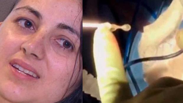 SOFFRE DI MAL DI TESTA E INCUBI: IL RACCAPRICCIANTE RITROVAMENTO ALL'INTERNO DEL SUO CERVELLO - 18/04/2017