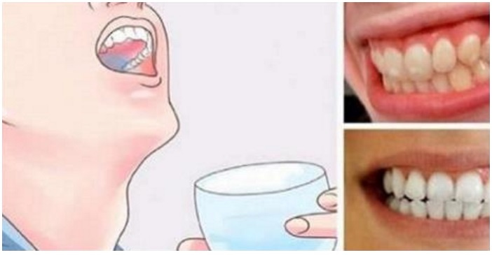SCIACQUA LA BOCCA CON QUESTO MIX PER 30 SECONDI: PLACCA E TARTARO ANDRANNO VIA ALL'ISTANTE - 19/04/2017