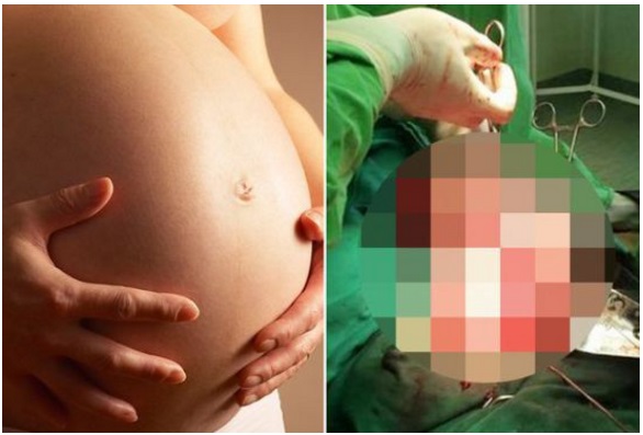PENSAVA DI ASPETTARE UN BAMBINO E INVECE FA UNA SCOPERTA TERRIBILE - 02/05/2017