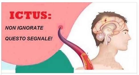 ICTUS - QUEL SINTOMO ''SILENZIOSO'' CHE DOBBIAMO ASSOLUTAMENTE CAPIRE IN TEMPO PER SALVARCI - 03/05/2017