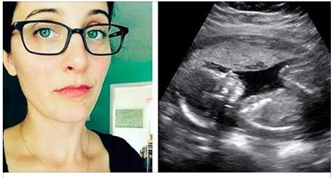 STANCA DI CHI LE CHIEDEVA PERCHE' NON AVESSE UN FIGLIO: HA DATO LORO LA MIGLIOR RISPOSTA CHE SI POSSA IMMAGINARE - 03/05/2017