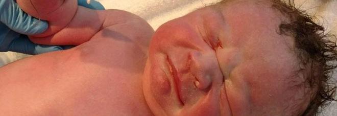 BIMBO NASCE TENENDO IN MANO IL CONTRACCETTIVO DELLA MAMMA: ''HAI FALLITO''. LA FOTO DIVENTA VIRALE - 05/05/2017