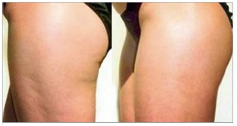30 CALORIE OGNI 100 GRAMMI: L'ALIMENTO PERFETTO PE RIL TUO CORPO - 31/05/2017