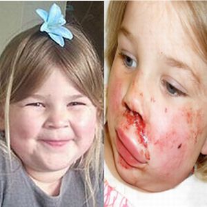 BAMBINA DI 4 ANNI PICCHIATA A SANGUE DA 15 BULLI - 01/03/2014