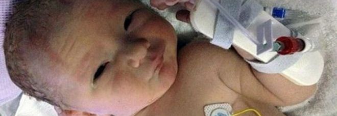 IL BIMBO 'IMMORTALE', PICCOLO EROE A SETTE MESI: È SOPRAVVISSUTO A 5 OPERAZIONI AL CUORE - 13/05/2014