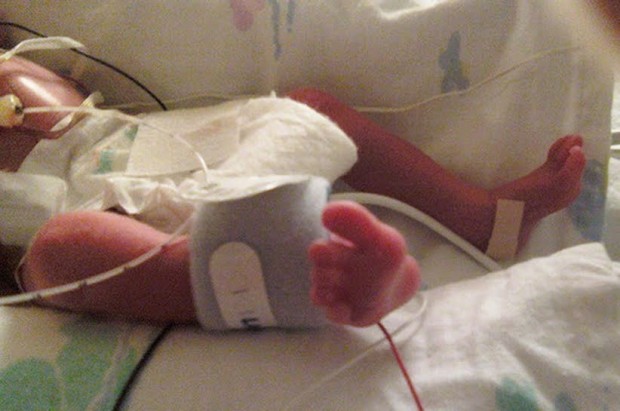 IL MIRACOLO DEL BIMBO PREMATURO TORNATO IN VITA GRAZIE AL CALORE DI MAMMA - 28/10/2014