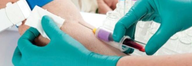 RISCHI DI MORIRE ENTRO CINQUE ANNI? TE LO DICE UN'ANALISI DEL SANGUE - 28/02/2014
