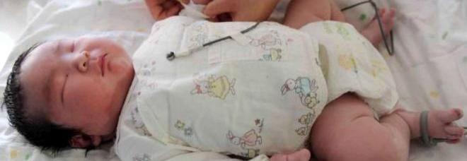 IL BIMBO È PREMATURO, MA PESA GIÀ PIÙ DI 6 CHILI: NATO DOPO UN PARTO DURATO DUE ORE - FOTO - 04/04/2014