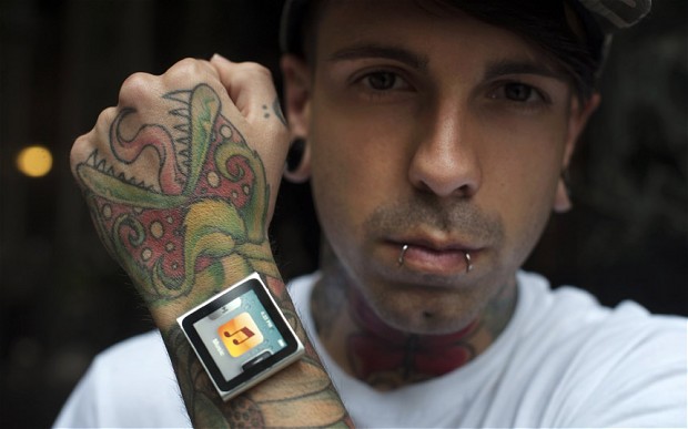 IL RAGAZZO CHE SI E' FATTO IMPIANTARE UN IPOD NEL BRACCIO - FOTO - 10/07/2014