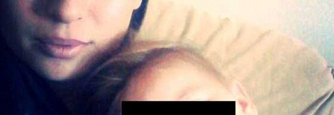 LA MAMMA INCINTA FU COLPITA DA UN FULMINE: LA PICCOLA, UN ANNO, HA ANCORA I CAPELLI DRITTI - FOTO - 14/07/2014