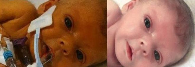 LA FIGLIA NEONATA MUORE, IL PADRE: ''VORREI VEDERLA SENZA TUBI''. E IL WEB LO ACCONTENTA - FOTO - 16/07/2014