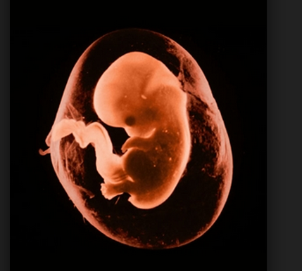 VI RACCONTO LA MIA STORIA: INCINTA DI 8 MESI UN MEDICO MI DISSE ''SI AUGURI CHE SUA FIGLIA NASCA MORTA'' - LEGGI - 18/06/2014