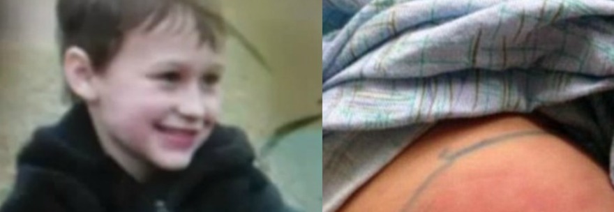 MUORE A CINQUE ANNI PER IL MORSO DI UN RAGNO: ''COLPA DEL PIGIAMINO APPENA COMPRATO'' - 01/02/2015