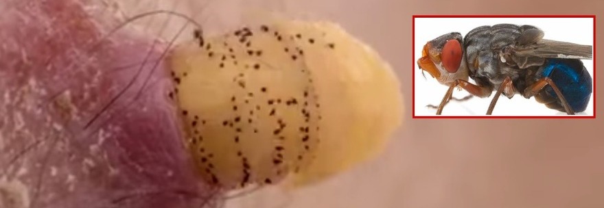 SCOPRE UNA LARVA NEL SUO BRACCIO: LA ESTRAE E LA INSERISCE DI NUOVO PER STUDIARLA - 04/03/2015