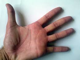 FORMICOLIO ALLA MANO SINISTRA? - ECCO COSA SIGNIFICA - 02/02/2015