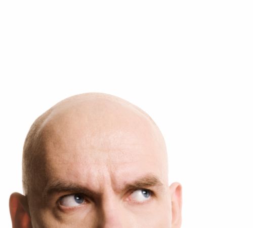 ECCO QUALI SONO I BENEFICI DI NON AVERE I CAPELLI - 27/05/2015
