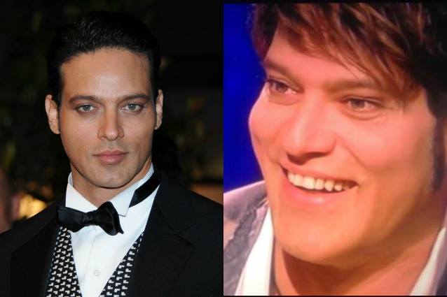 GABRIEL GARKO E LA SUA STRANA 'METAMORFOSI'. ''MA QUALE BOTOX, HO UN PROBLEMA DI SALUTE...'' - 07/05/2015