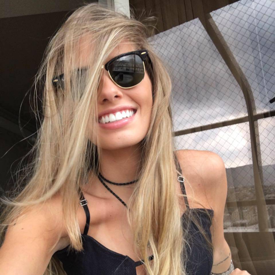 PAOLA, MODELLA CORAGGIO: PERDE LA GAMBA IN UN INCIDENTE. NON PERDE IL SORRISO E CONTINUA A SFILARE - 03/04/2016