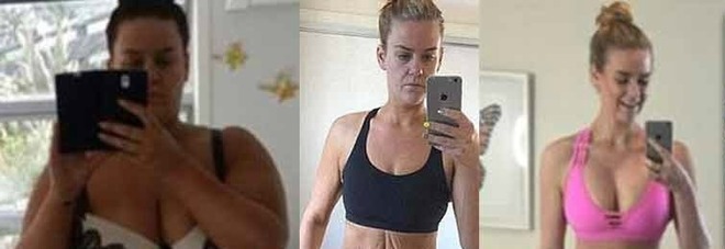 PERDE 92 KG MA RIMUOVE LA PELLE IN ECCESSO CON LA CHIRURGIA: L'INCREDIBILE TRASFORMAZIONE - 23/05/2016