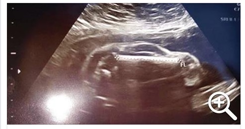 DONNA INCINTA VA A FARE L'ECOGRAFIA: QUELLO CHE MOSTRANO LE IMMAGINI SORPRENDE TUTTI... - 13/06/2016