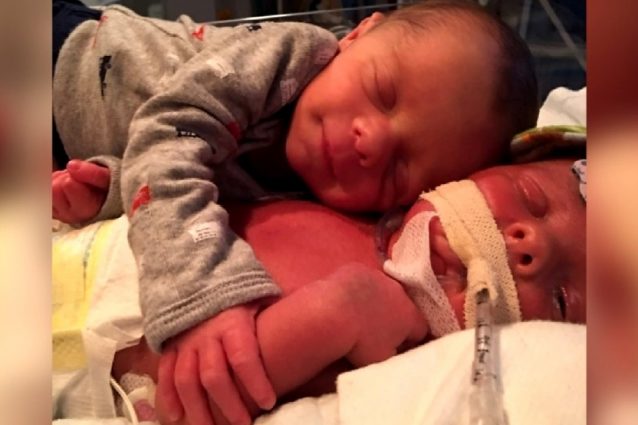 LA FOTO CHE SPEZZA IL CUORE: BIMBO STA MALE, IL GEMELLINO LO ABBRACCIA PER FARLO ADDORMENTARE - 08/09/2016