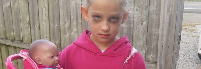 OCCHIAIE E VISO ESAUSTO A 7 ANNI, LA FOTO DELLA BAMBINA NASCONDE UN SEGRETO - 02/11/2016