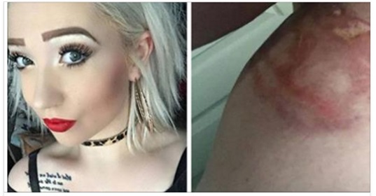 L'APPUNTAMENTO DA INCUBO DI MELISSA: ECCO COSA E' SUCCESSO ALLE SUE PARTI INTIME - 03/11/2016
