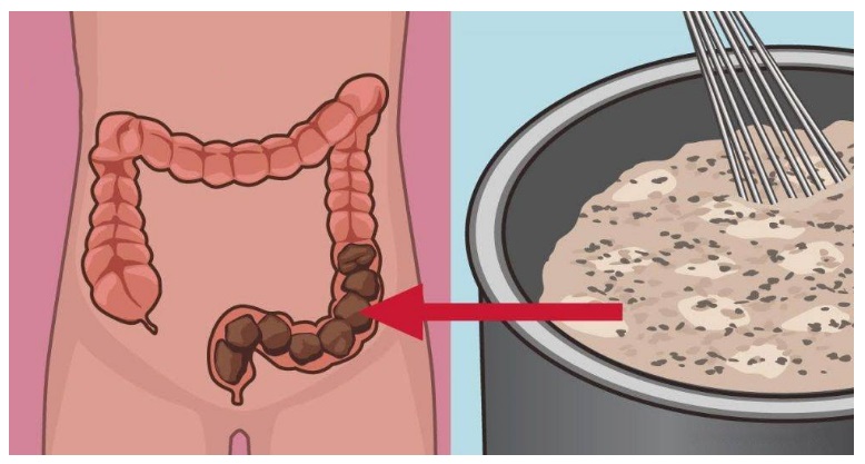 POTRESTI AVERE 15 KG. DI TOSSINE NEL TUO CORPO. ECCO LA RICETTA NATURALE PER DISINTOSSICARE IL COLON - 25/11/2016