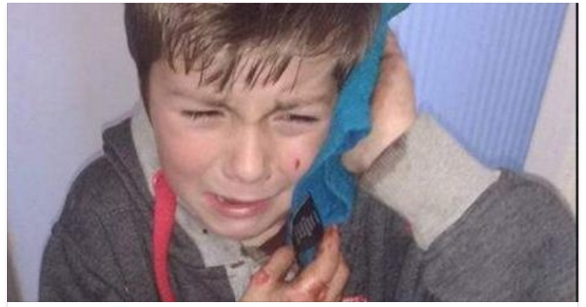 BIMBO DI 7 ANNI AGGREDITO DAI BULLI MENTRE PORTA LA LETTERINA A BABBO NATALE - 08/12/2016