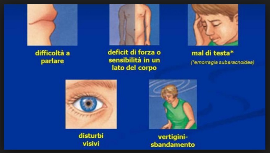 ''IN TANTI NON SANNO RICONOSCERE QUESTI SINTOMI'' ECCO COME SALVARSI DALL'ICTUS - 21/12/2016