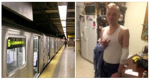 SI ADDORMENTA SULLA METROPOLITANA: UN 18ENNE GLI DA FUOCO SENZA MOTIVO E RIDE - 24/01/2017
