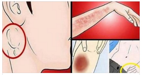 QUESTI 7 SEGNALI INDICANO CHE POTRESTI AVERE IL CANCRO: MOLTI NON LO CAPISCONO FINCHE' NON E' TROPPO TARDI - 28/03/2017