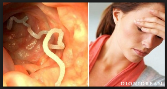 PARASSITI INTESTINALI: ECCO I SINTOMI PIU' COMUNI DI INFESTAZIONE - MOLTISSIME LE PERSONE COLPITE - 03/04/2017