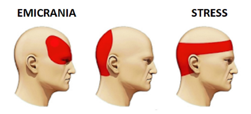 COME DIRE ADDIO AL MAL DI TESTA IN 5 MINUTI SENZA MEDICINE O PILLOLE: QUANDO SCOPRIRAI IL PERCHE' LO FARAI ANCHE TU - 03/04/2017
