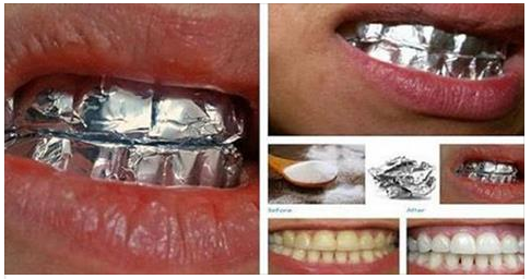 IL RIMEDIO FAI DA TE PER SBIANCARE I DENTI INGIALLITI: RESTERETE MOLTO SORPRESI - 03/04/2017