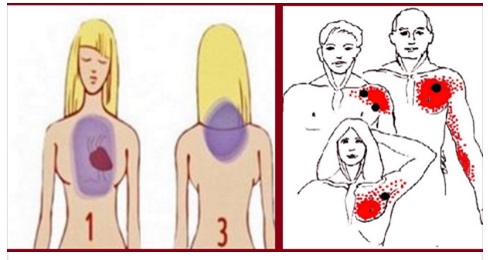 L'OMS INFORMA: I 5 SEGNALI CHE INDICANO UN INFARTO UN MESE PRIMA CHE ACCADA - SCOPRILO CON UN SEMPLICE TEST - 03/04/2017