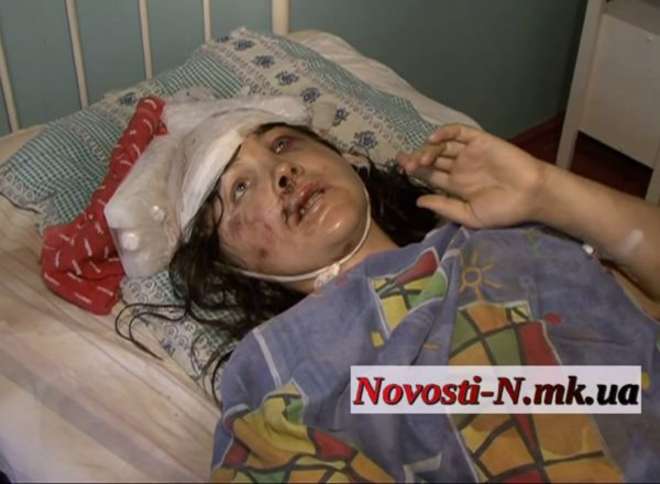 IRINA, 29 ANNI, VIOLENTATA E PICCHIATA DALLA POLIZIA: ''MI HANNO UMILIATA IN OGNI MODO'' - 21/07/2013