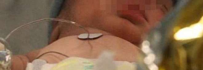 PIANGE TROPPO E IL PADRE LO SCUOTE, BIMBO DI 2 SETTIMANE RISCHIA LA VITA - 02/10/2013