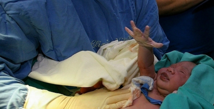 Il ginecologo la fa nascere dopo dieci mesi, muore nel grembo della mamma - 15/10/2013