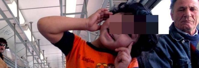ACIDO DAL BALCONE SU UN BIMBO ROM: È GRAVE. ''USTIONI OVUNQUE, ABITINI BRUCIATI'' - 15/10/2013