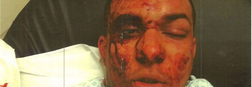 FRANCESCO COME JOELE: UN ALTRO RAGAZZO PICCHIATO A SANGUE A LONDRA - 24/10/2013