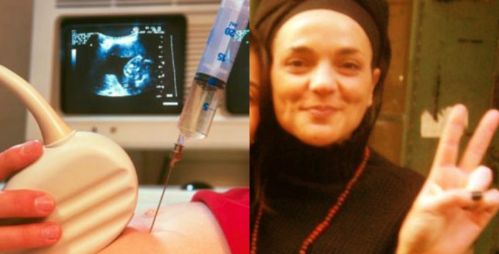 TRAGEDIA NELLA TRAGEDIA: UNA 35ENNE MUORE POCHE ORE DOPO L'AMNIOCENTESI CHE AVEVA PROVOCATO UN ABORTO SPONTANEO - 30/10/2013
