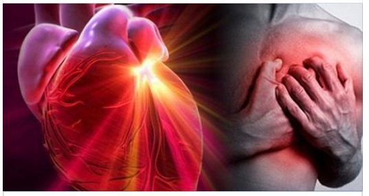 LA SCOPERTA SHOCK: I CAPELLI AVVERTONO DI UN INFARTO UN MESE PRIMA - ECCO COSA VERIFICARE - 23/11/2016