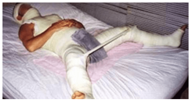 UN UOMO E' RIMASTO CASTRATO DOPO UN TENTATIVO DI STUPRO DI UN PIT-BULL: ECCO COS'E' SUCCESSO - 12/12/2016