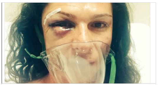 CADE DALLA MOTO: ANZICHE' SOCCORRERLA, ECCO COSA LE FANNO 4 UOMINI - 14/12/2016